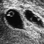 Υπερηχογραφήματα Υπερηχογραφήματα