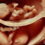 κύηση υψηλού κινδύνου