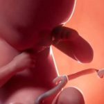 παρακολούθηση κατά την κυηση παρακολούθηση κατά την κυηση